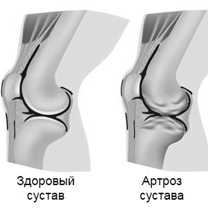 лікування