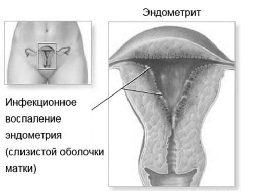 можна