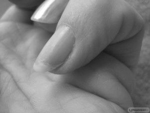 Чому тріскаються нігті на руках: причини поздовжніх тріщин тріскаються