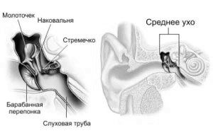 Симптоми і лікування отиту середнього вуха середнього