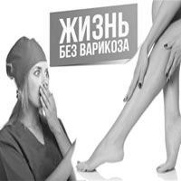 варикозне