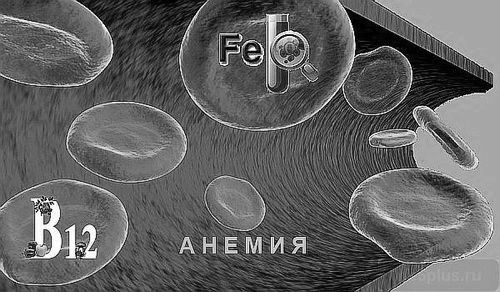 Хвороба анемія: причини, симптоми, харчування, лікування хвороба анемія