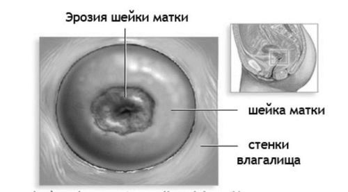 лікувати