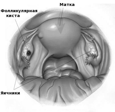 лікування