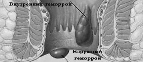 кровообіг