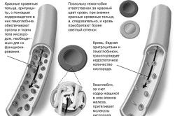 Лікування анемії народними засобами анемії