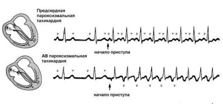 симптоми