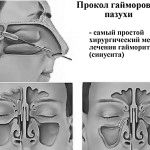 причини