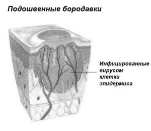 стопі