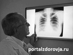 Рак легенів на останній стадії - портал здоров'я людини статті про здоров'я