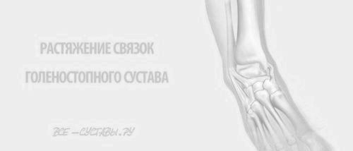 Розтягнення зв'язок гомілковостопного суглоба і їх лікування розтягнення зв'язок гомілковостопного суглоба лікування симптоми