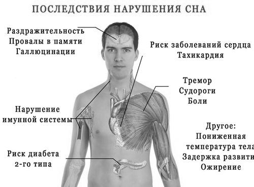 Тахікардія і сон - ночами, після відпочинку, вранці, причини, лікування після