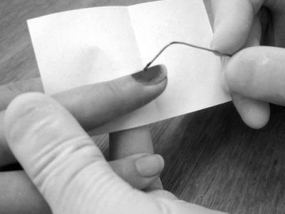 Забій нігтя на руці: що робити, якщо почорнів ніготь на руці, перша допомога при синіх нігтях на руках ніготь