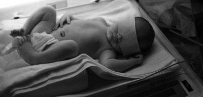 Жовтяниця грудного вигодовування у новонароджених: симптоми, причини і лікування грудного