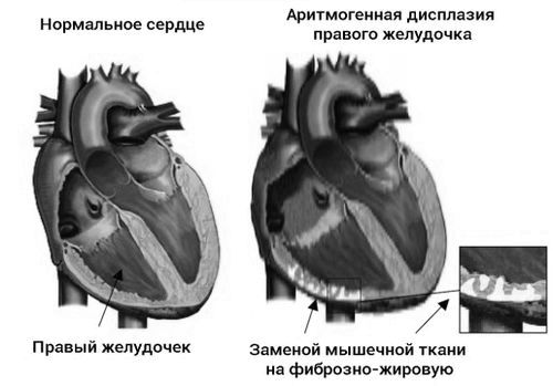 ритм