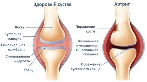 профілактика