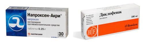 Хрускіт в суглобах: причини та лікування, до якого лікаря звертатися... профілактика