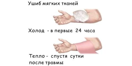 Забій руки лікування