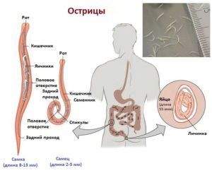 Як позбутися від глистів в домашніх умовах швидко і ефективно як лікувати глисти гострики