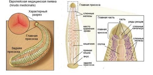 як лікувати варикоз з п'явками