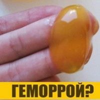 геморой