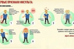Спинальний інсульт: симптоми, лікування і наслідки як лікувати спинальний інсульт