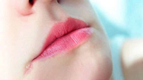 Заїди в куточках рота: причини і лікування як лікувати заїди в куточках рота швидко