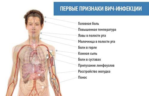 вич жінки симптоми лікування спід стадії фази ознаки інфекція препарати профілактика