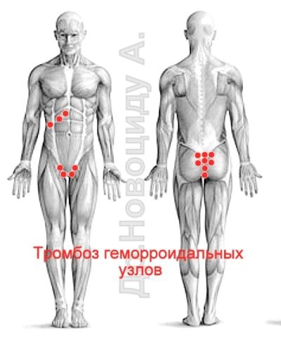 лікувати печінку п'явками