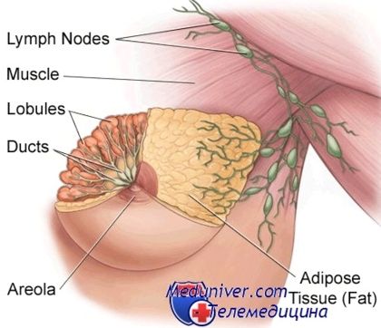 лімфовузли при хворобах молочних залоз