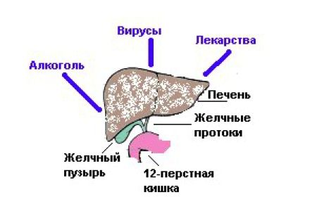 як лікувати токсичне отруєння