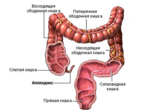 як лікувати папіломи в прямій кишці