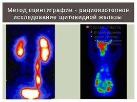 Хто ще хоче спробувати лікування простати содою? як лікувати тиск содою