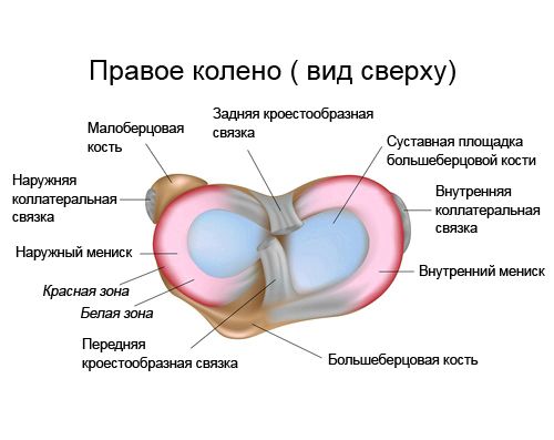 Пошкодження меніска колінного суглоба, операція на меніску розрив меніска біль операція артроскопія хірургія