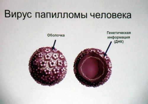 як вилікувати бородавку під нігтем