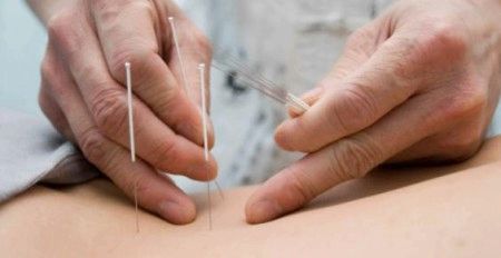 Китайська медицина і акупунктура при безплідді китайська медицина безплідність