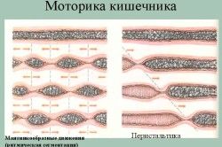 як вилікувати постійне бурчання в животі