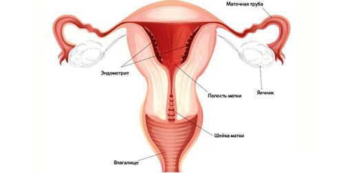 чи можна вилікувати трихомоніаз гомеопатією