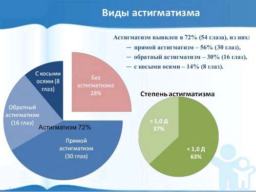 як лікувати вроджений астигматизм