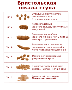 причини запору