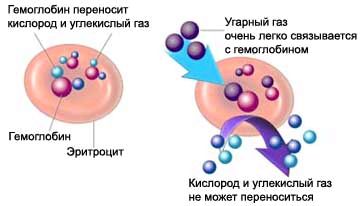 лікувати отруєння чадним газом