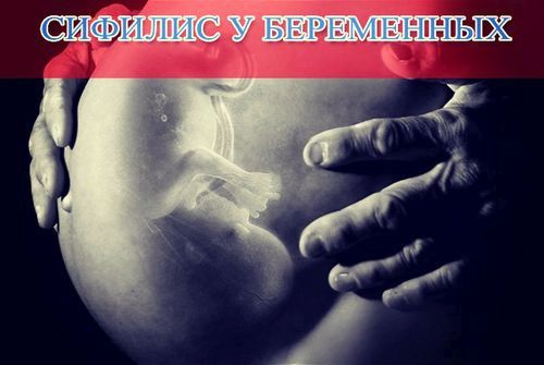 Сифіліс у вагітних - симптоми інфекції і дитини як лікувати сифіліс у вагітних