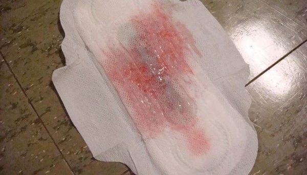 Виділення після пологів: скільки йдуть в нормі? Які за кольором і обсягом? (місячних може) гормональний фон