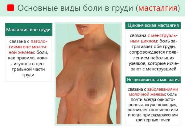 Болять соски: перед місячними, після, чому, затримка і тест негативний (менструальний цикл) затримка місячних і біль у грудях