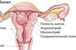 Часті місячні: причина (менструації) хвороби матки