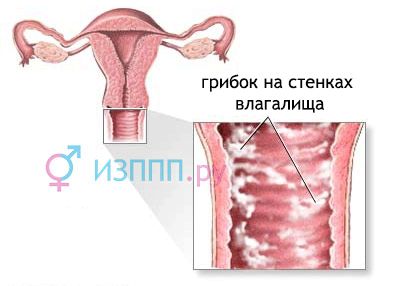 Виділення в жінок: білі, коричневі, жовті (білі слизові виділення після місячних) менструальним циклом
