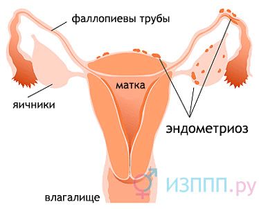 Виділення в жінок: білі, коричневі, жовті (менструації) менструальним циклом