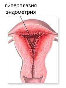 Виділення в жінок: білі, коричневі, жовті (менструальний цикл) місячних