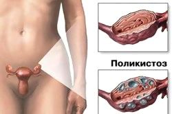 Затримка 2 тижні: тест негативний (затримка місячних 15 днів) менструального циклу