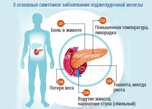 Първите симптоми на заболяване на панкреаса
